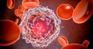 cancer-stats-2022-who.jpg