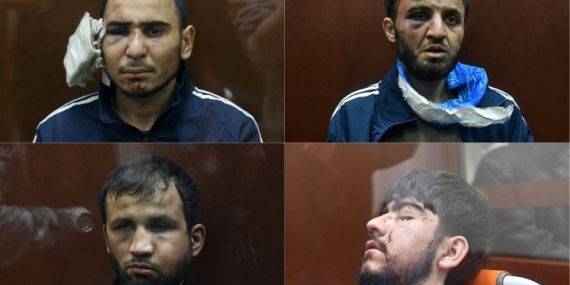 Moscow attack suspects appear beaten in court, raising questions of torture – National