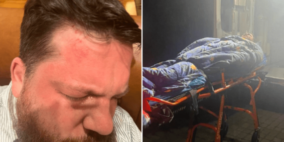 Former top aide to Alexei Navalny attacked with hammer, blames ‘Putin’s henchmen’ – National