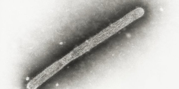 2nd human case of bird flu in U.S. detected in Michigan farm – National