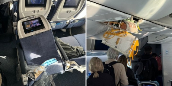 Severe turbulence injures 36 on Boeing flight, fracturing necks and skulls – National