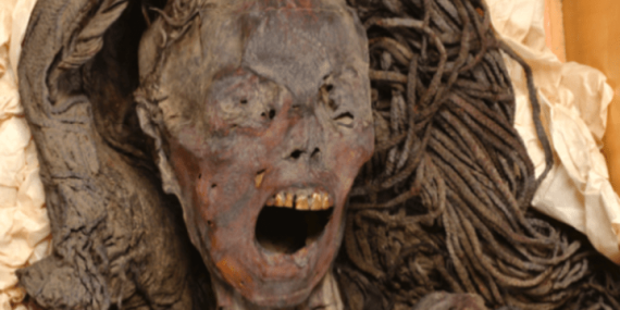 Egyptian mummy may have died ‘screaming from agony,’ researchers say – National
