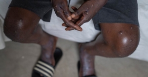 mpox-africa.jpg