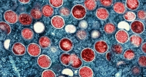 mpox-africa-emergency.jpg
