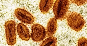 mpox-strain.jpg