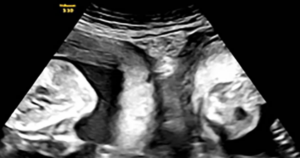 The-hospital-released-this-ultrasound-image-it-said-was-taken-during-Lis-pregnancy.png